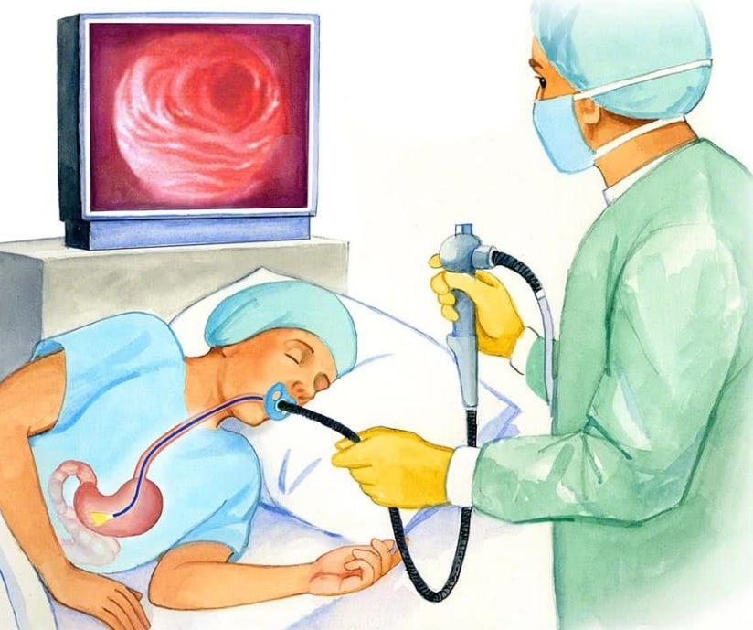 эндоскопия в староминской